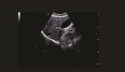 Клиническое изображение MyLab X7 Esaote фото1