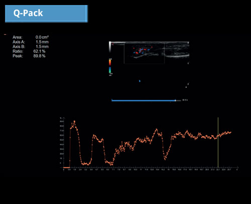 Q-Pack: Инструмент для мультимодальной количественной оценки для анализа кривой контрастной перфузии (Wi/Wo)