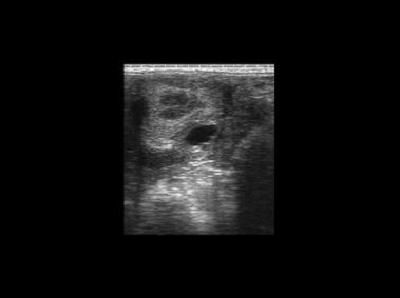 Клиническое изображение – Tringa Linear VET – лошадь: недавняя овуляция яичника